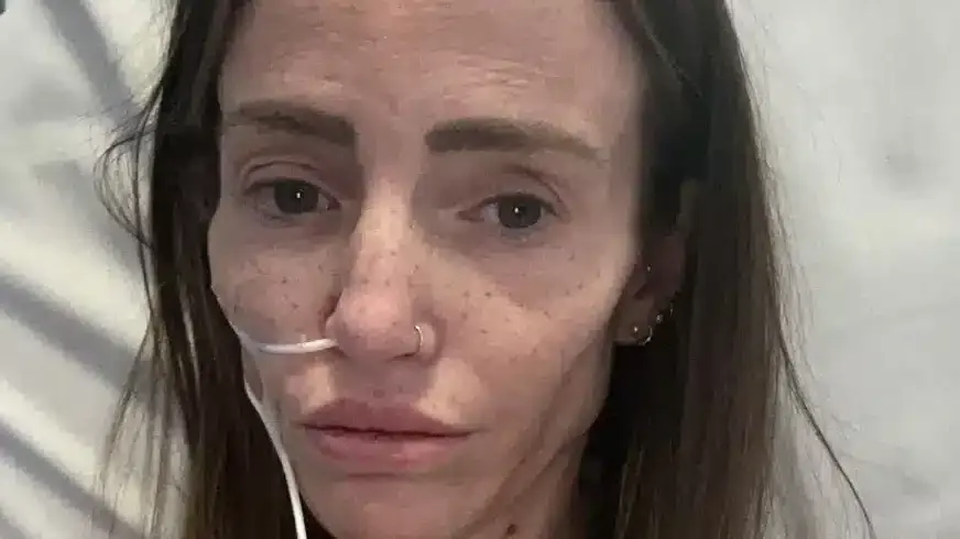 Mulher que achou que o cereal estava “estranho” agora está “