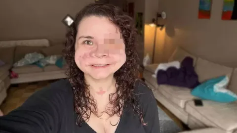 Mulher que recebeu “menos de 2%” de chance de sobrevivência 