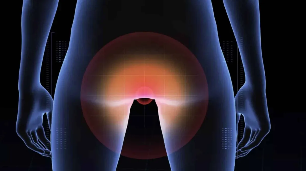 Novo estudo sugere que o câncer anal está em ascensão e reve