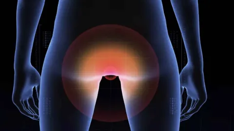 Novo estudo sugere que o câncer anal está em ascensão e reve