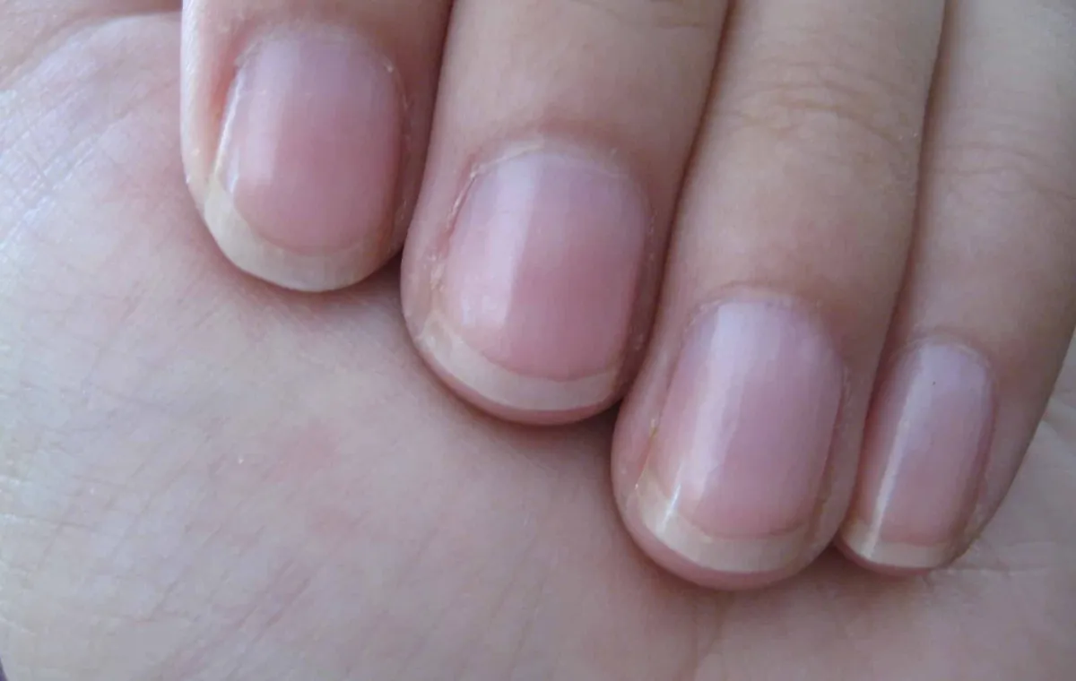 O que o crescimento das suas unhas revela sobre sua verdadei