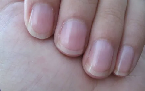O que o crescimento das suas unhas revela sobre sua verdadei