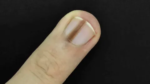Pessoas alertam homem para verificar seu dedo com um médico 