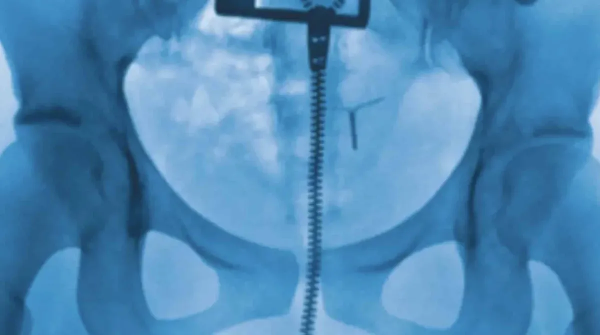 Pessoas chocadas ao descobrir detalhe perturbador que raio-X