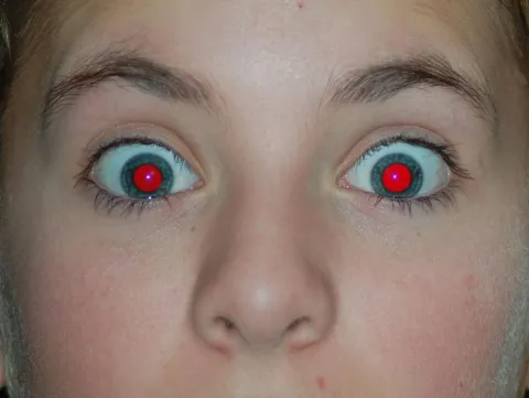 Por que as pupilas ficam vermelhas nas fotos com flash?
