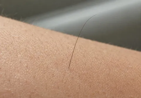 Por que às vezes aparece um pelo longo do nada no braço ou o