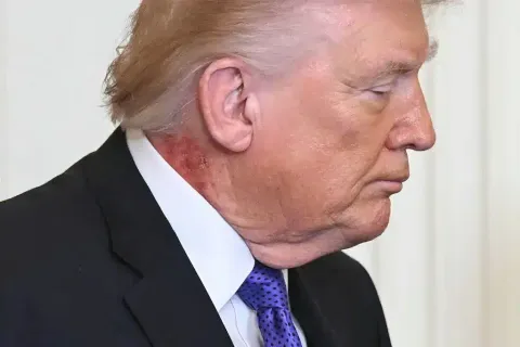 Preocupação com a saúde de Trump após espectadores notarem n