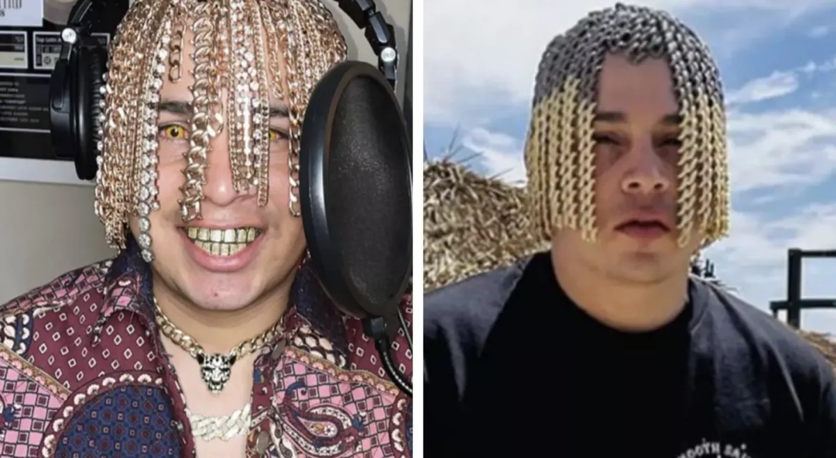Rapper enfrenta riscos graves após implantar correntes de ou