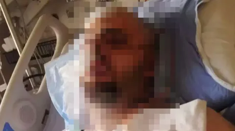 Sobrevivente de ataque de urso escreveu uma nota final arrep