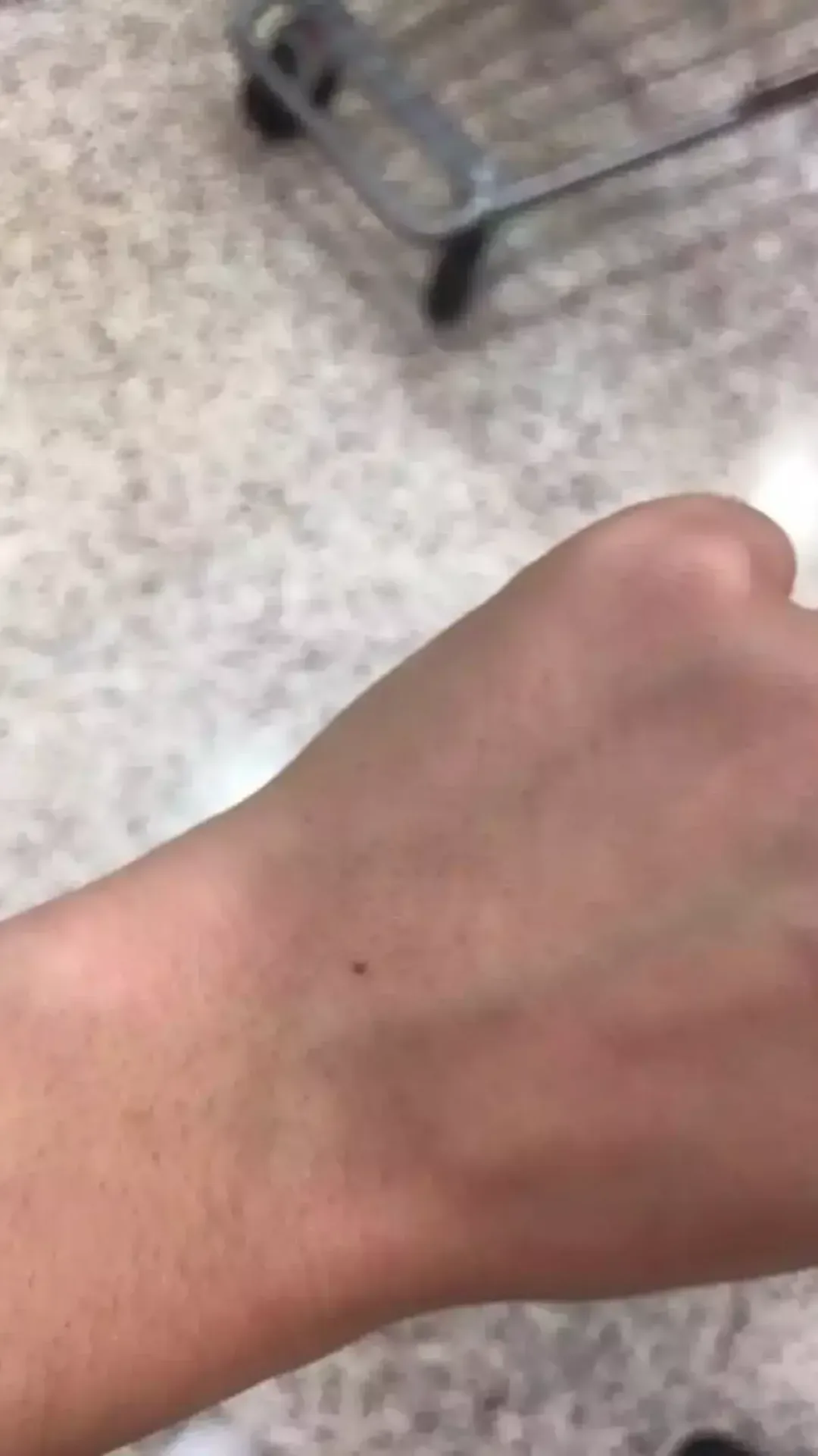 A razão pela qual tantas pessoas parecem ter a mesma pinta exata