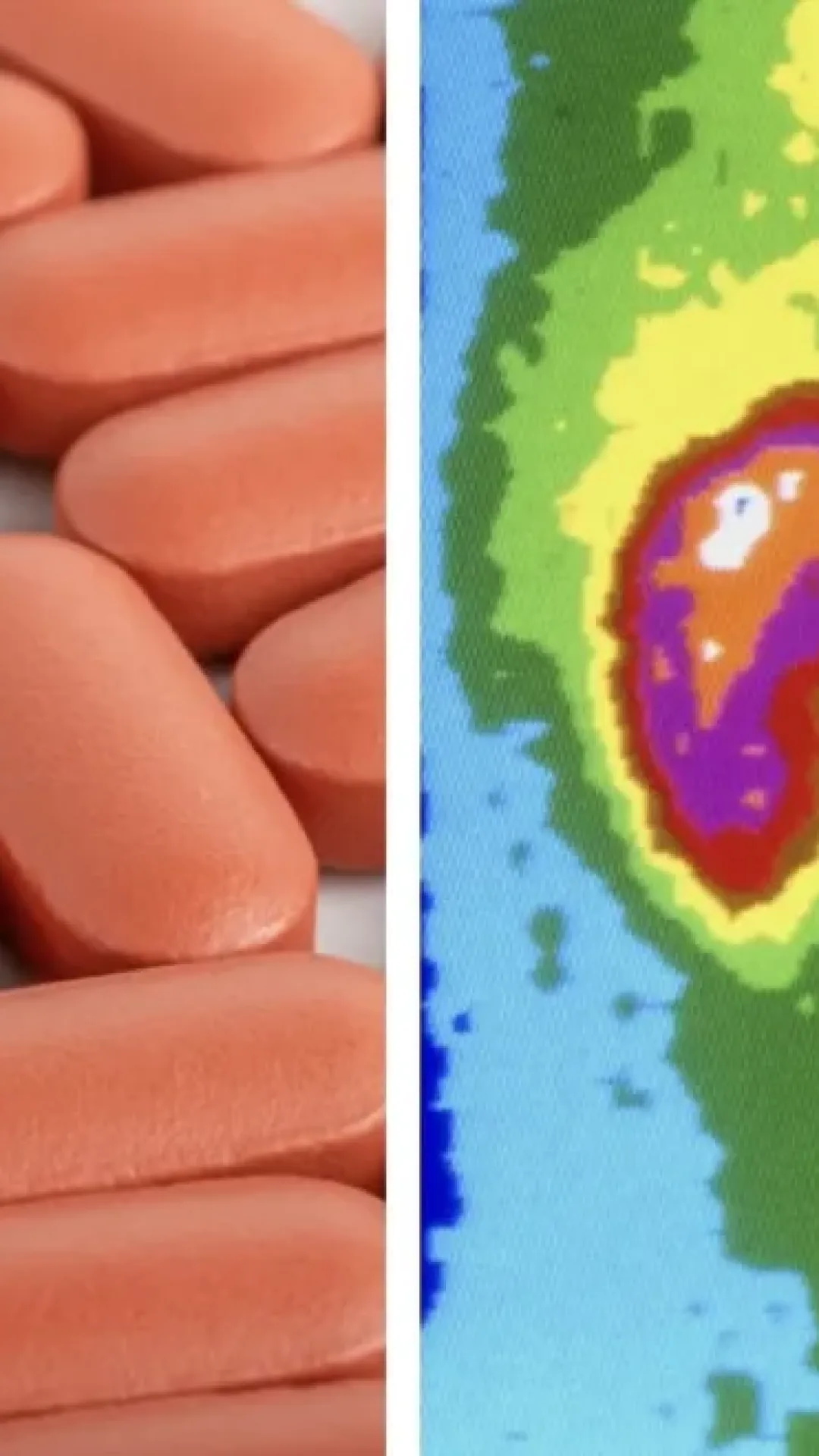Consequências graves que um homem sofreu após tomar 1.176 comprimidos de ibuprofeno em um mês