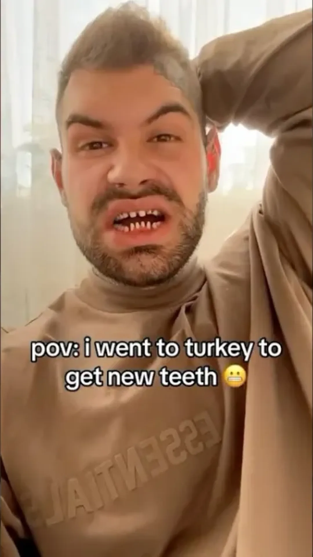 Dentista expõe o lado obscuro de quem faz o procedimento conhecido como “dentes turcos”