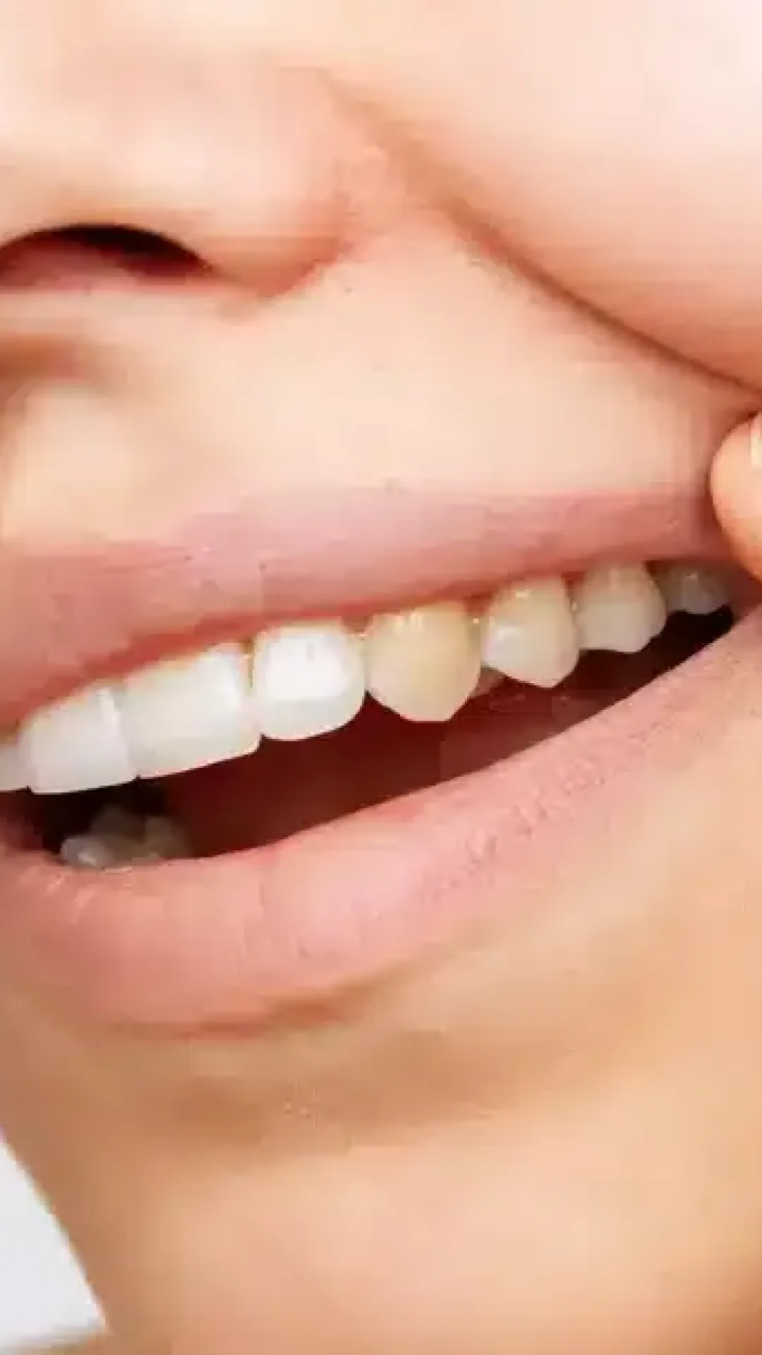 Dentista revela seis erros diários que as pessoas cometem e que deixam os dentes amarelados