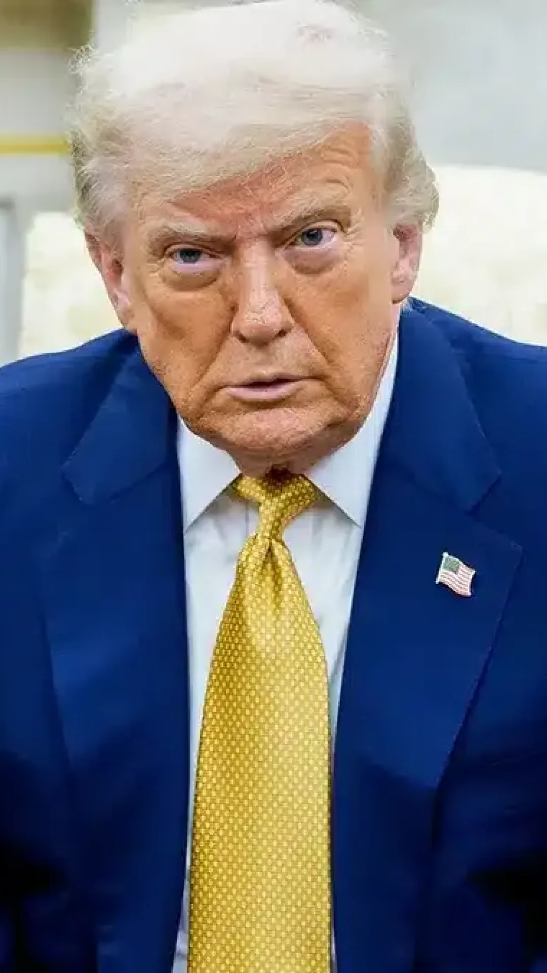 Donald Trump é diagnosticado com insuficiência venosa crônica