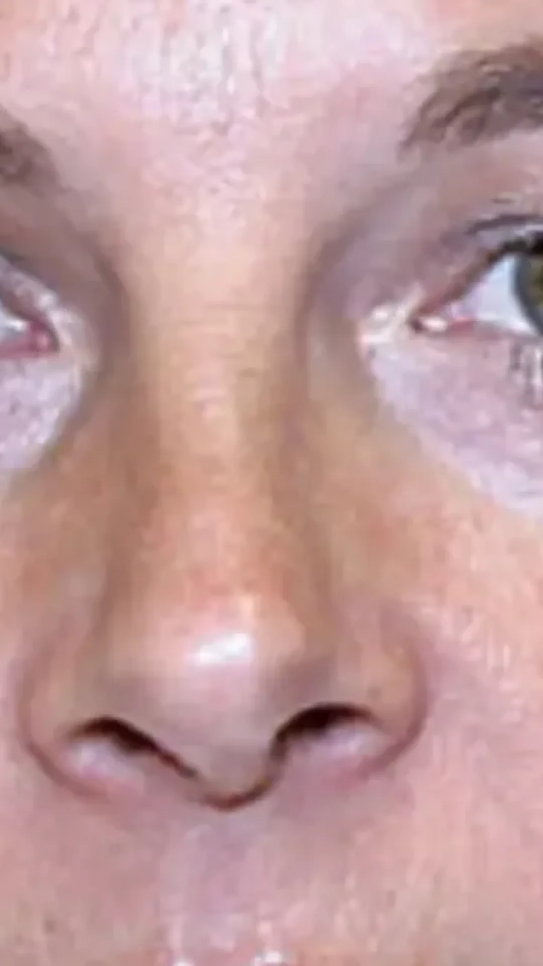 Gêmeas idênticas mostram grande diferença após uma usar botox por 20 anos e a outra não