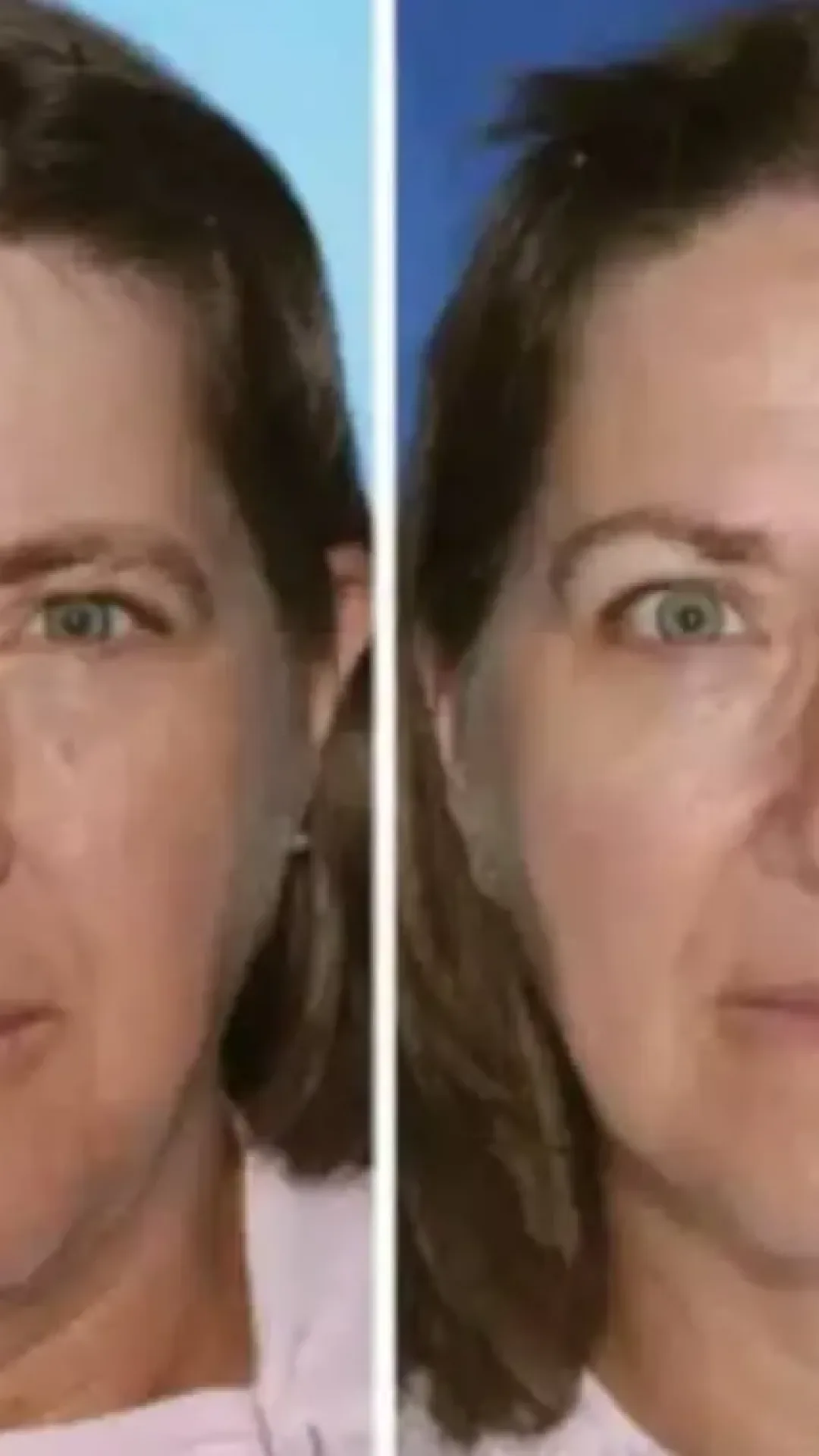 Gêmeos revelam mudança chocante no rosto após um deles fumar e o outro não