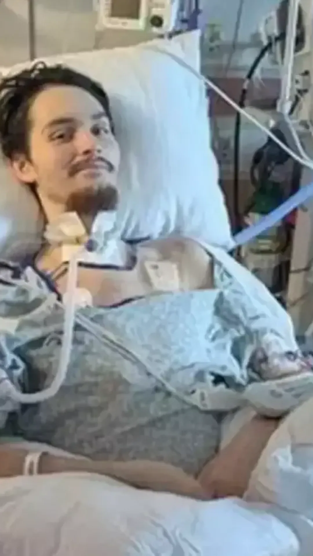 Homem acorda de coma e faz acusação chocante contra a namorada antes de morrer meses depois