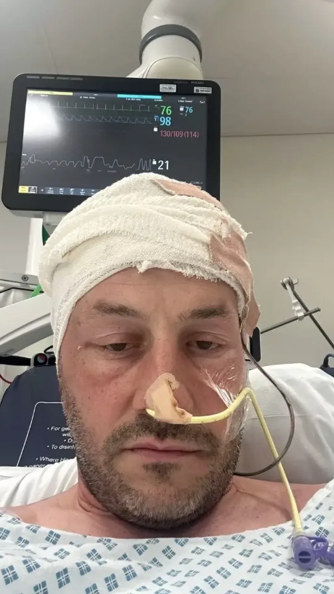 Homem é diagnosticado com dois tumores cerebrais após apresentar sintomas comuns de “ressaca”