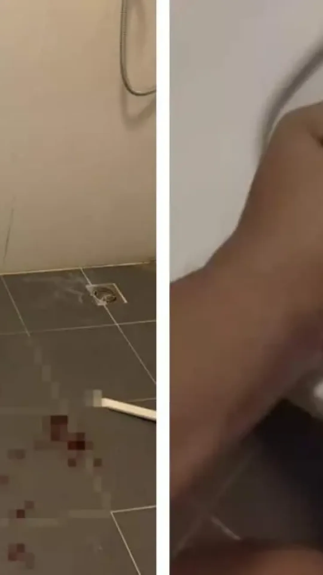 Homem mordido nos testículos por píton enquanto estava sentado no vaso sanitário
