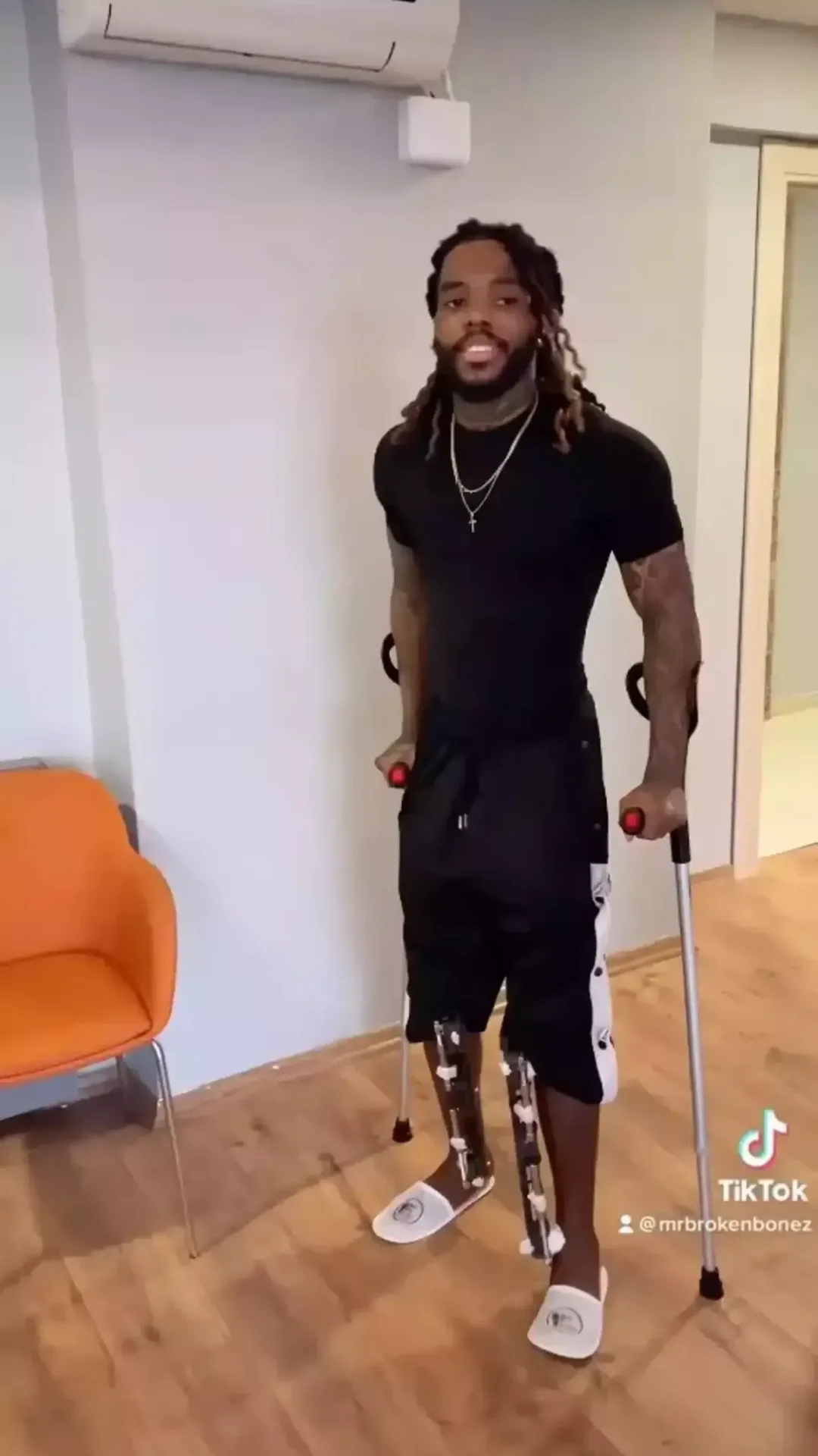 Homem que passou por cirurgia para aumentar a altura e foi de 1,68 m para 1,83 m compartilha atualização após procedimento final