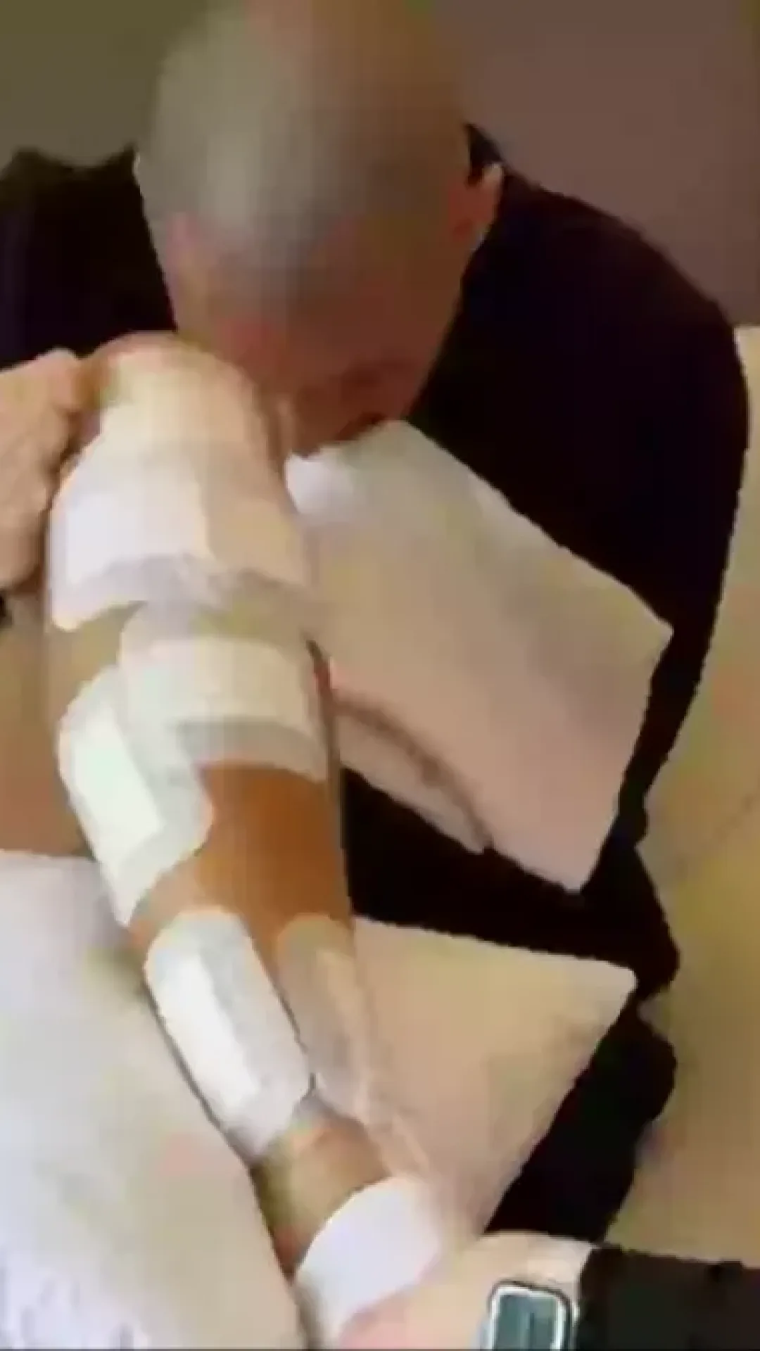 Homem que quebrou as próprias pernas para ganhar 23 cm de altura fala sobre sua experiência