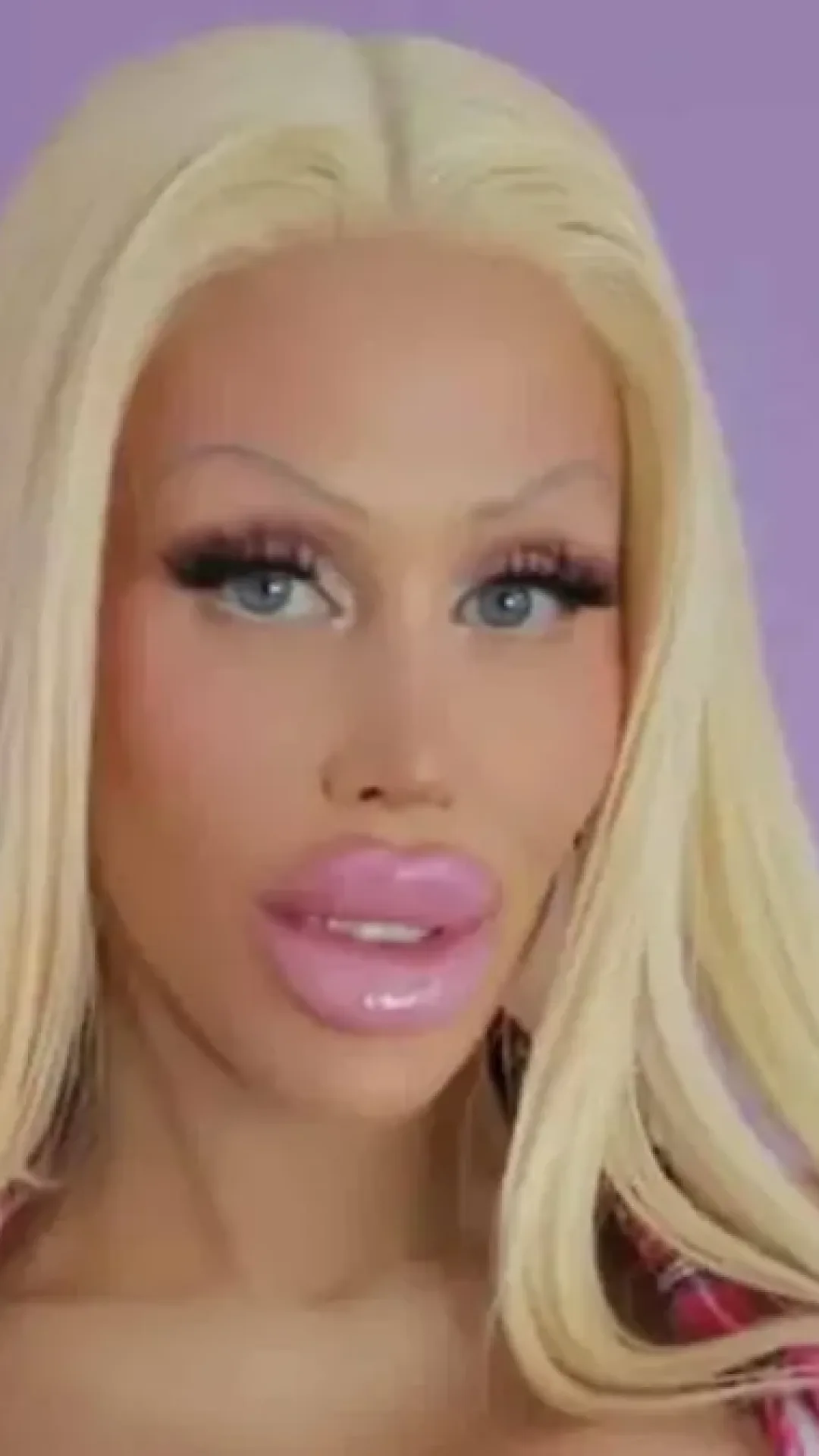Imagem chocante mostra como era a mulher que gastou R$ 1,8 milhão para se transformar na Barbie antes das cirurgias