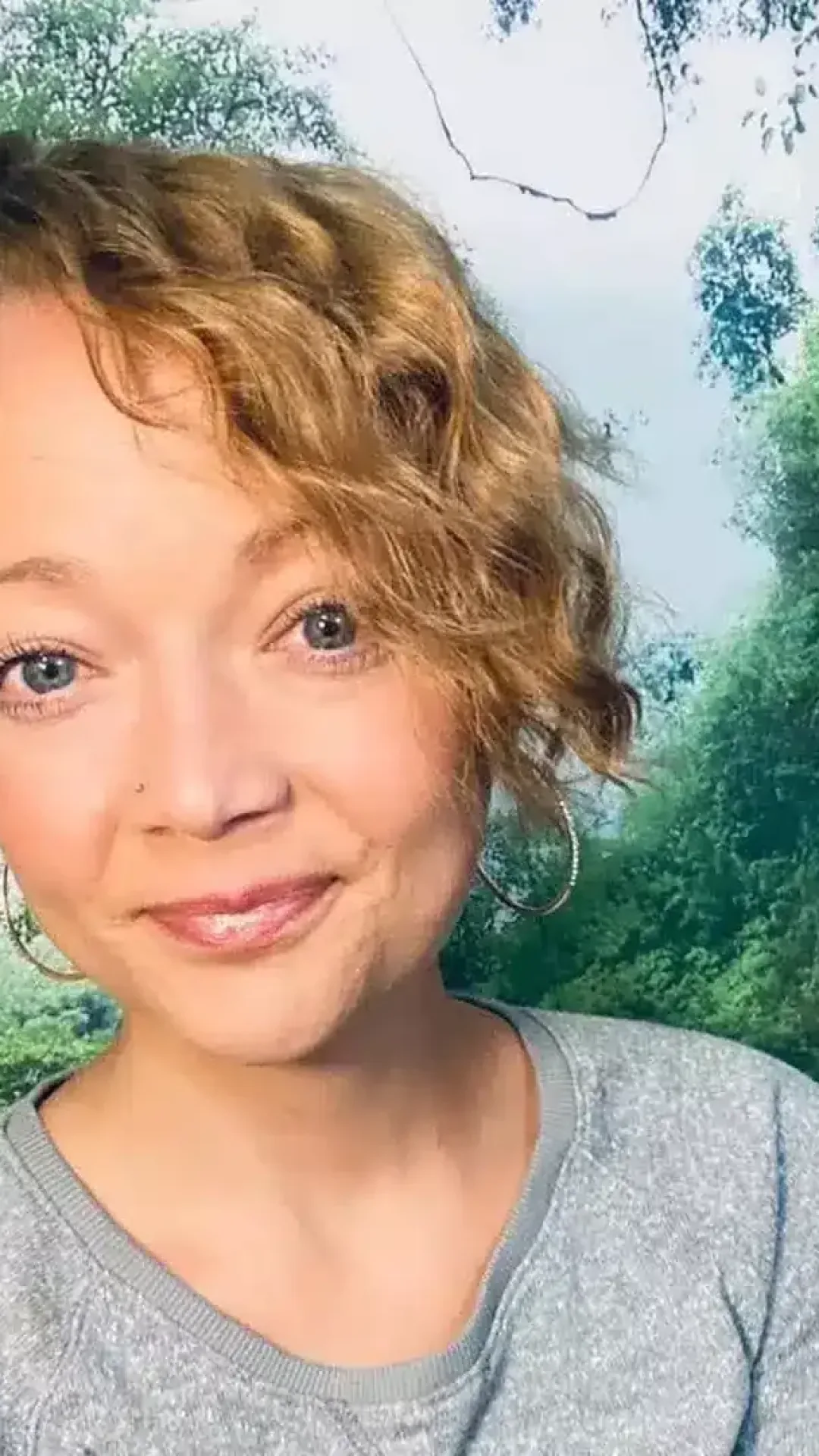 Mãe perde a perna após ataque do próprio pit bull, que deixou o membro “basicamente pendurado”