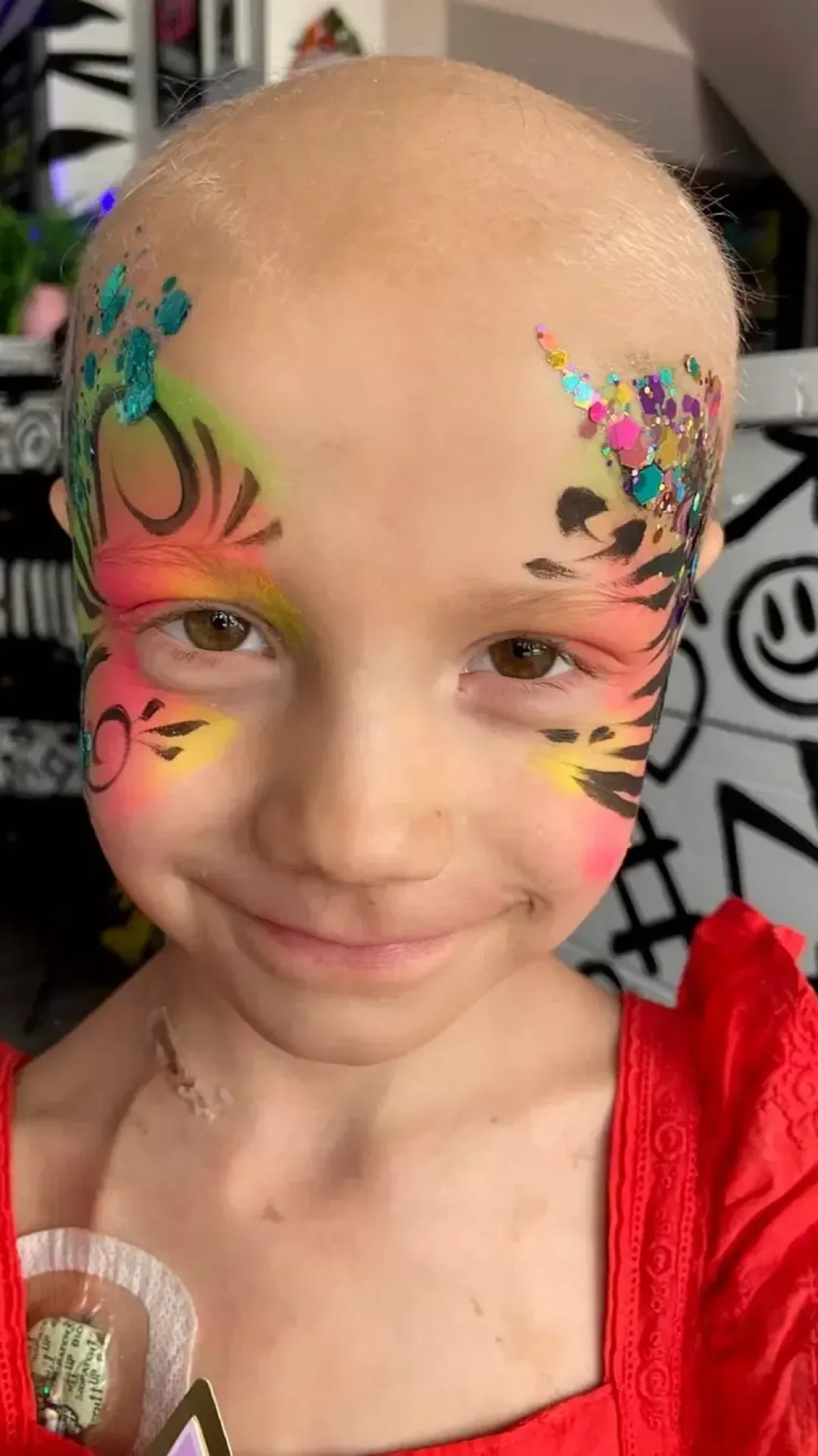Menina de seis anos recebe apenas semanas de vida após uma “torção no braço” se revelar câncer