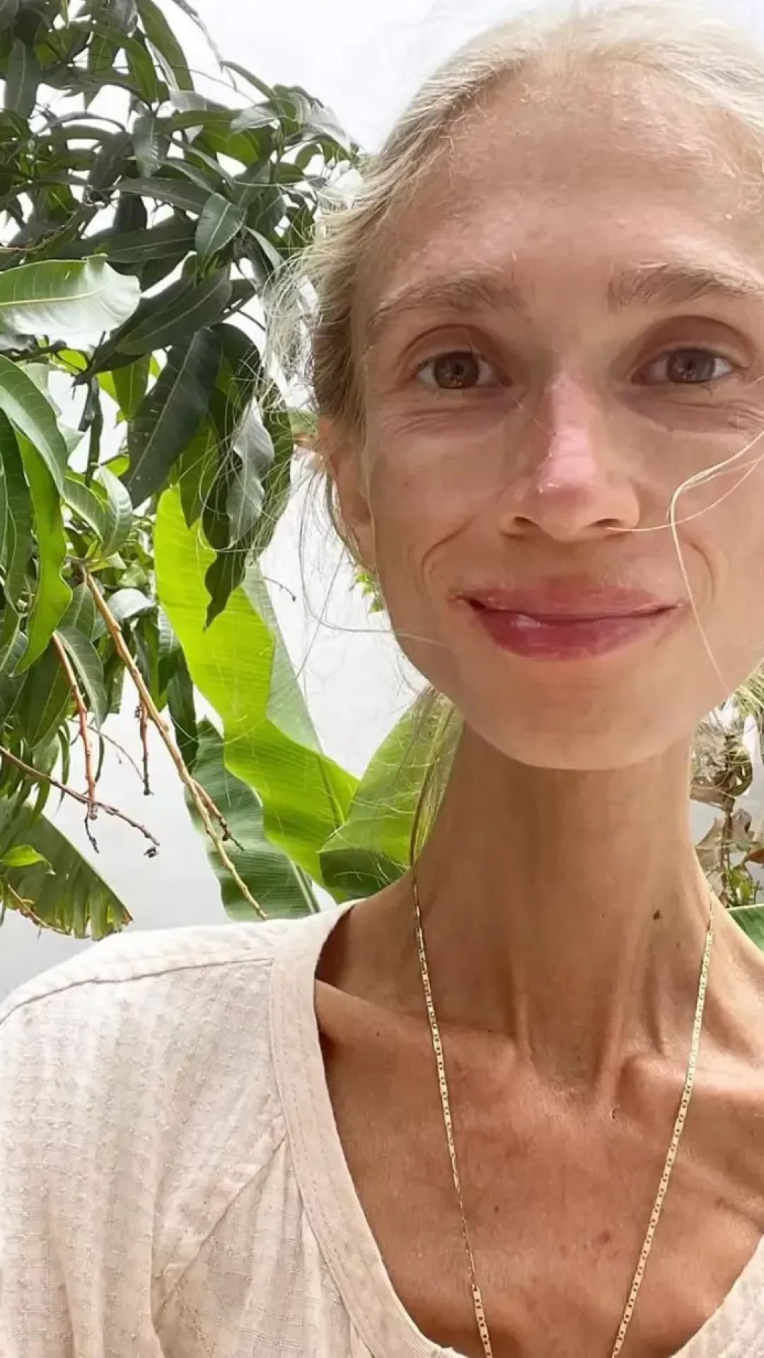 Mulher de 27 anos morre de fome em quarto de hotel após adotar uma dieta à base de frutas