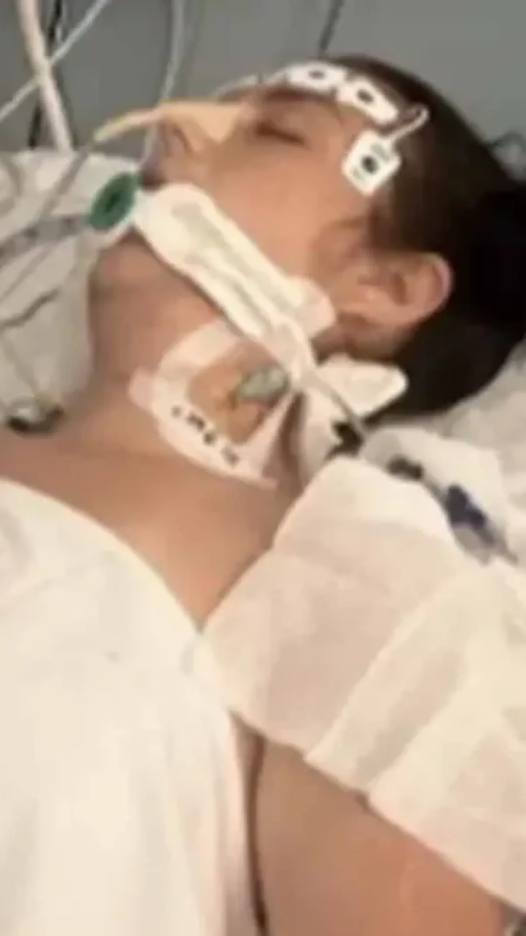 Mulher de 29 anos entra em coma após fazer tatuagem durante viagem de despedida de solteira