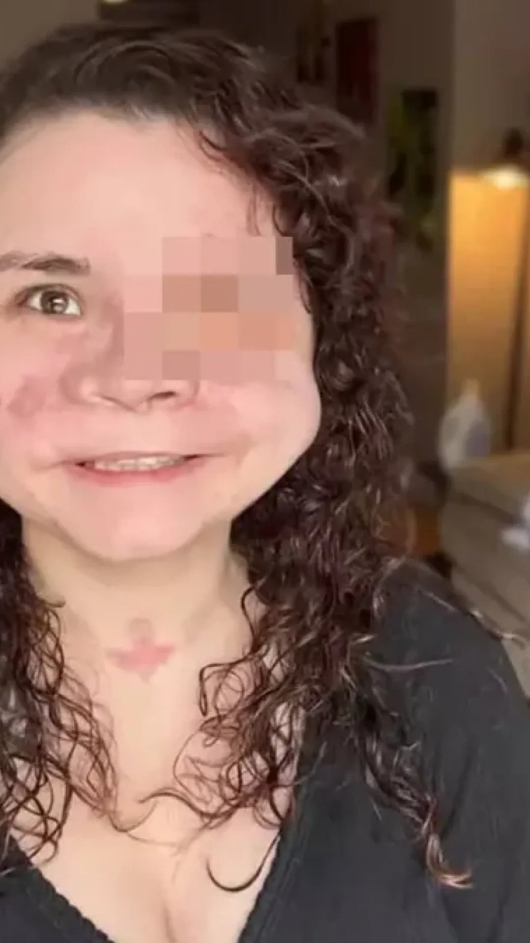 Mulher que recebeu “menos de 2%” de chance de sobrevivência após levar um tiro no rosto compartilha mensagem importante sobre trauma horrível