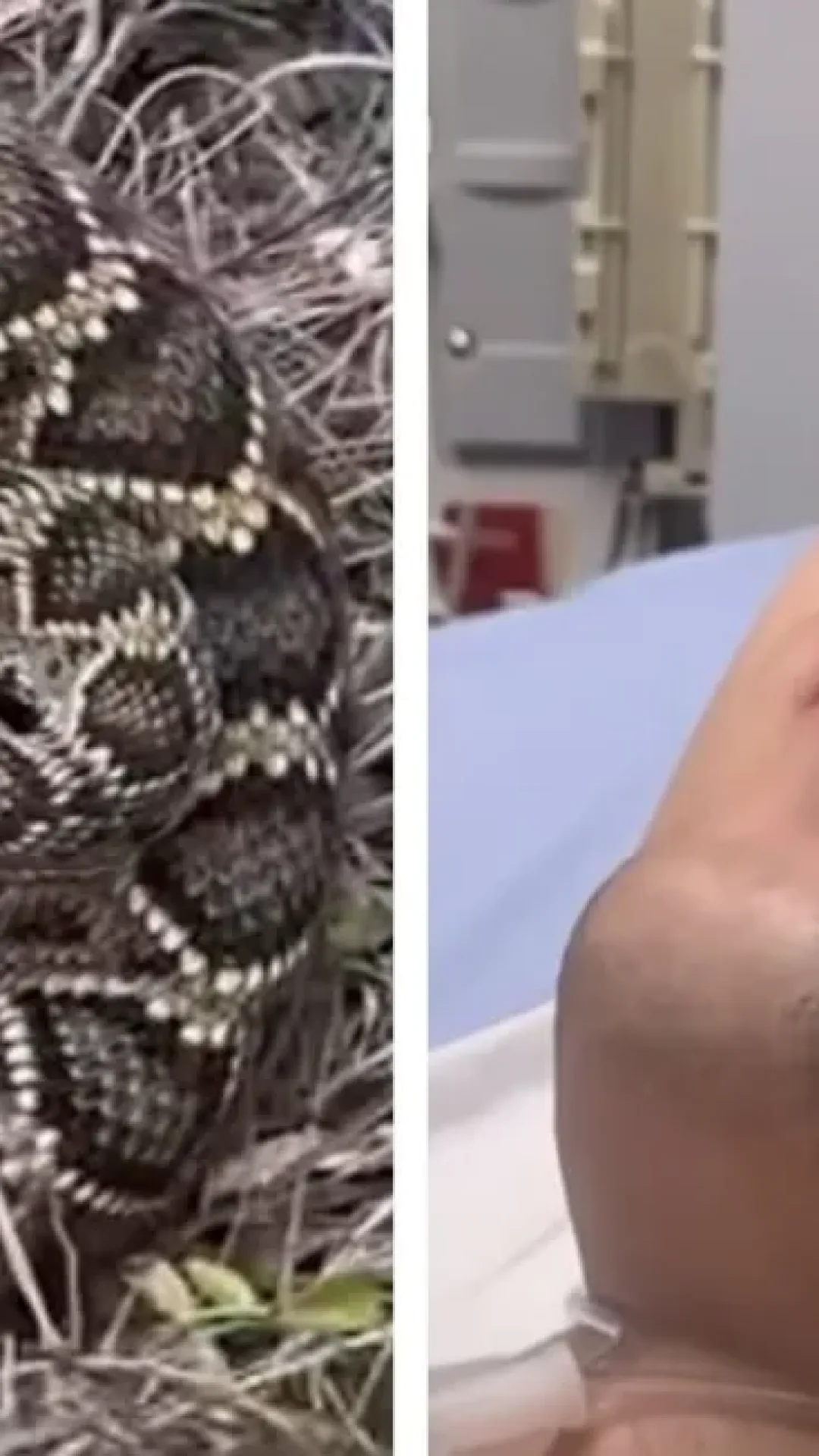 O momento aterrorizante em que influenciador transmite ao vivo enquanto é picado por uma cobra e internado na UTI