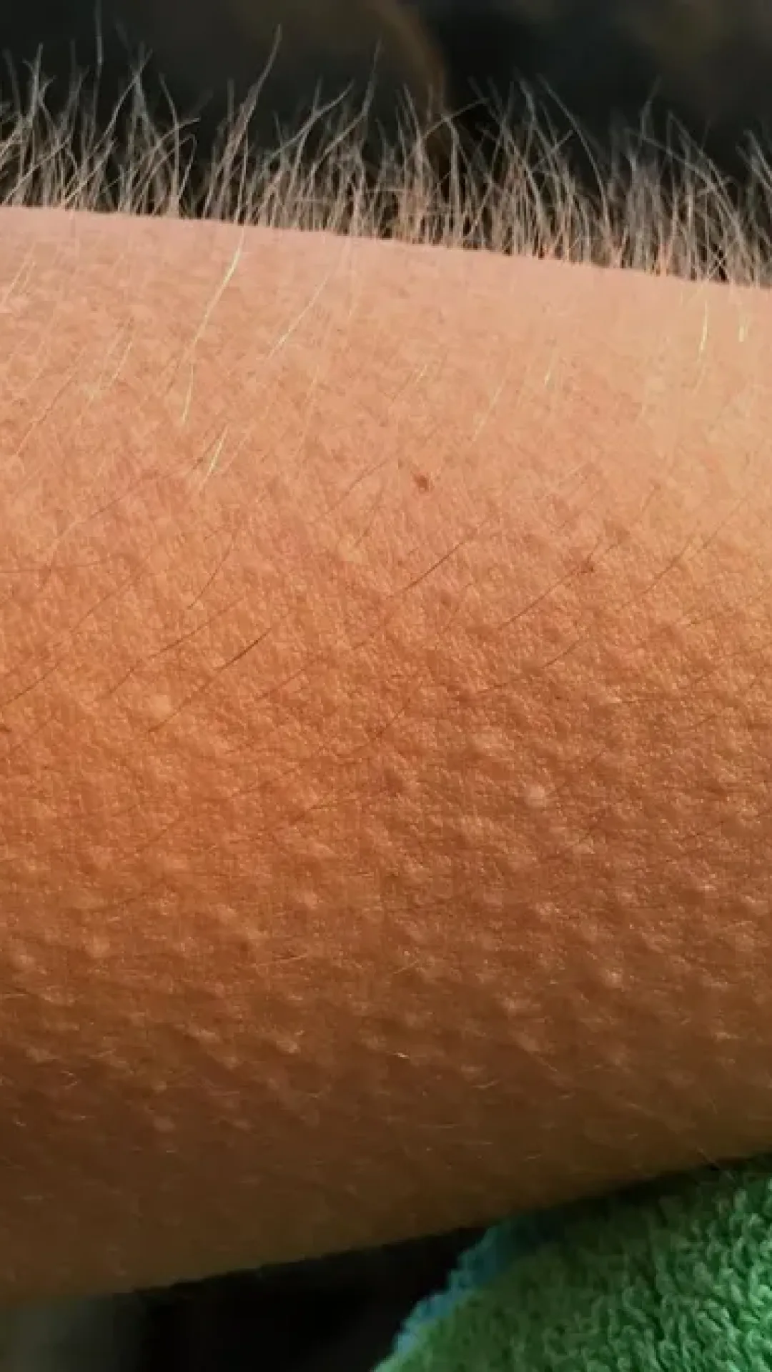 O que significa quando seu corpo arrepia do nada?