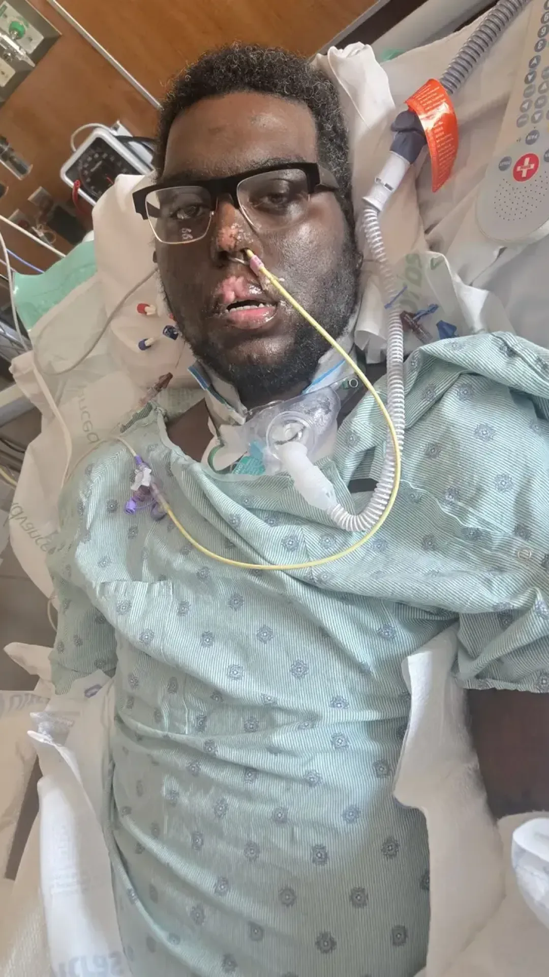 Pai de 34 anos entra em coma e perde os quatro membros após consulta de rotina no dentista