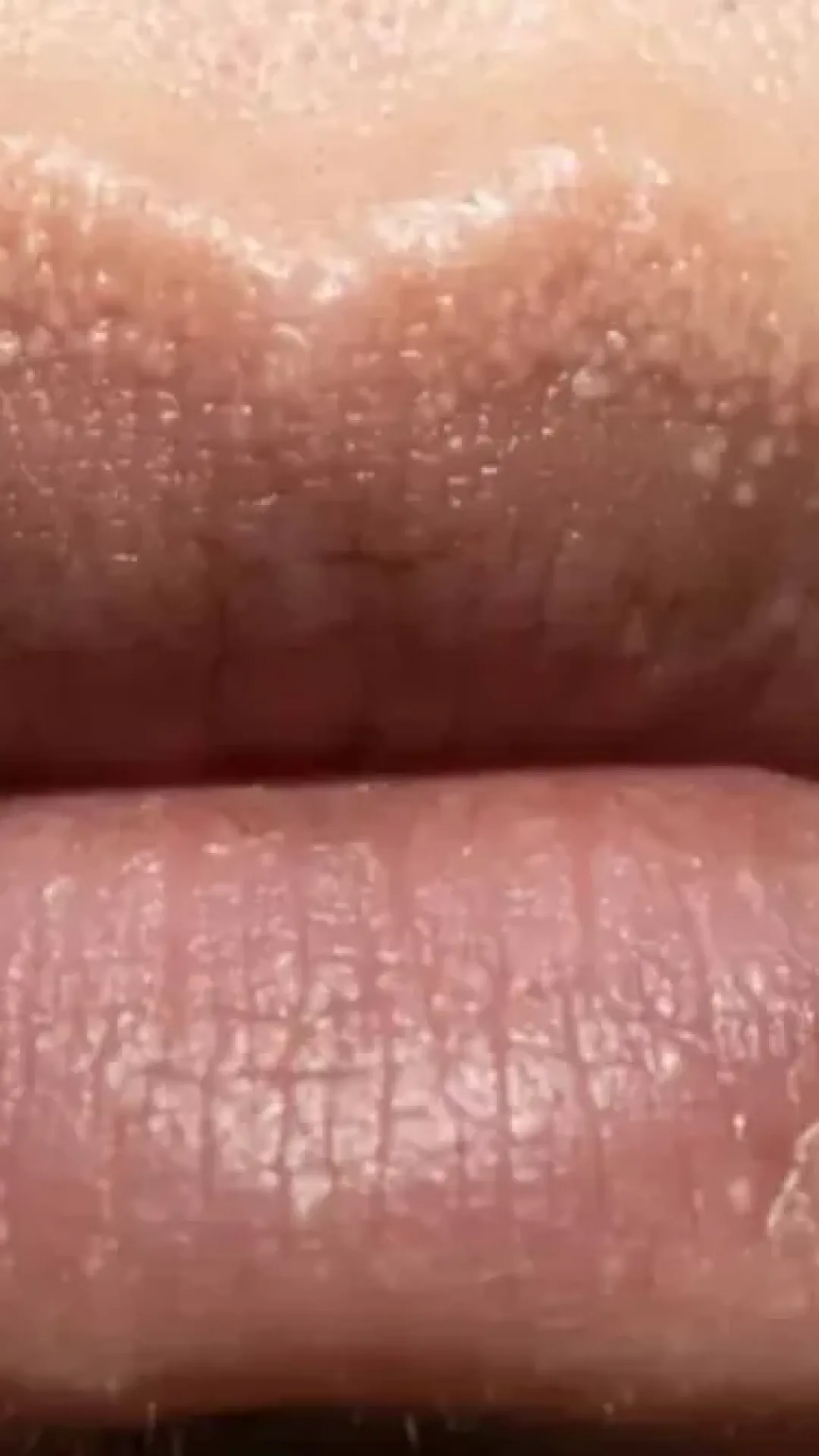 Por que algumas pessoas têm bolinhas brancas estranhas por todo o corpo, incluindo as partes íntimas?