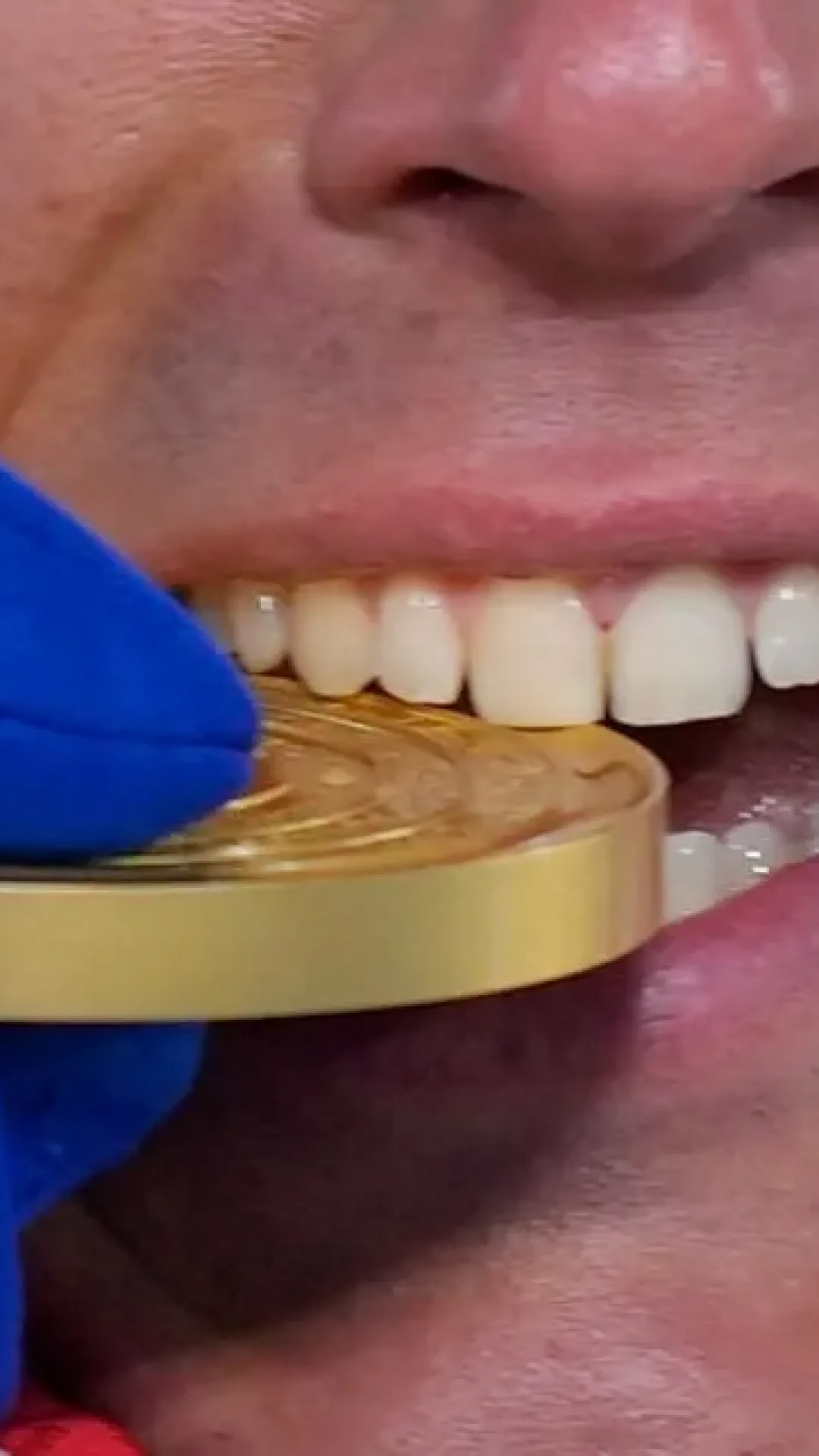 Por que os atletas olímpicos mordem suas medalhas?