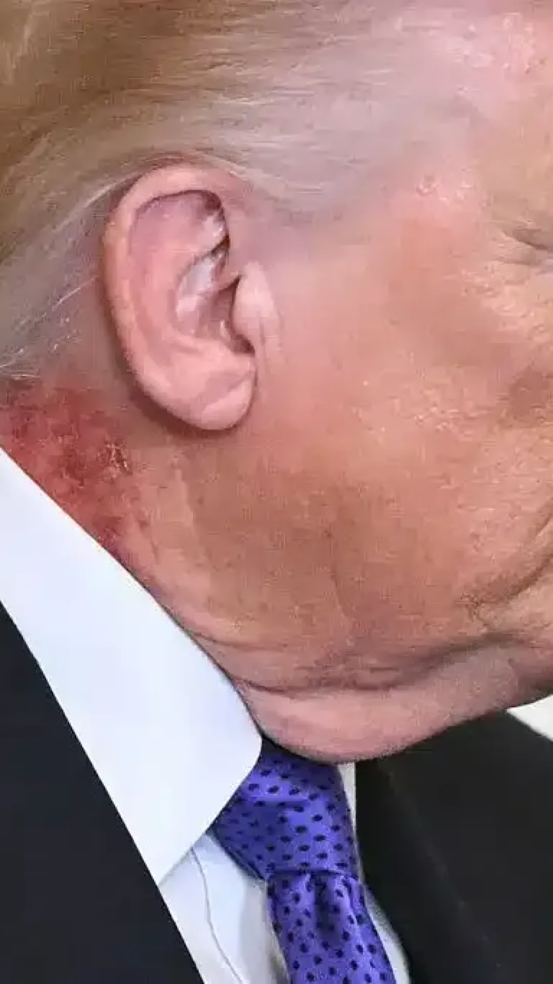 Preocupação com a saúde de Trump após espectadores notarem novo sinal durante discurso à nação
