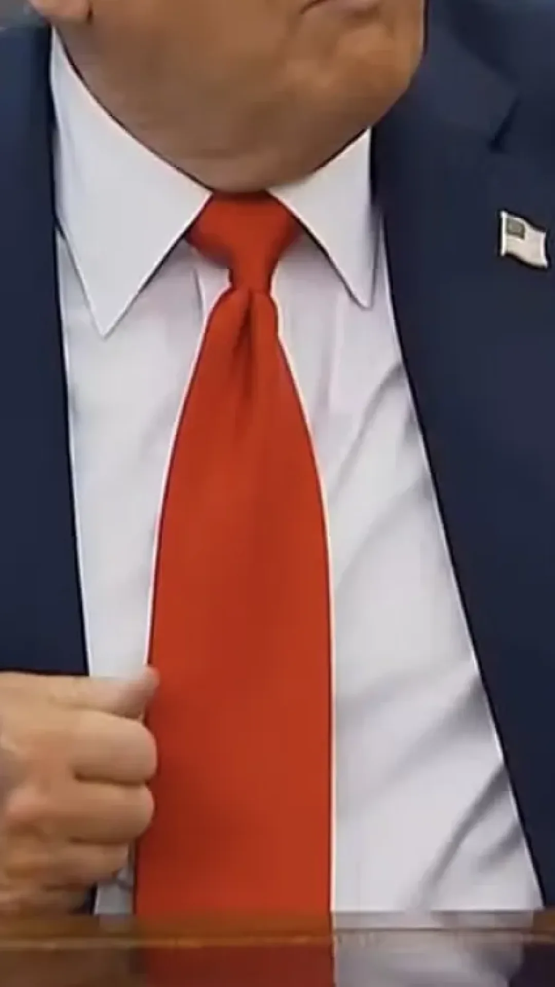 Trump aparece com mão roxa após diagnóstico de insuficiência venosa. O que isso significa?