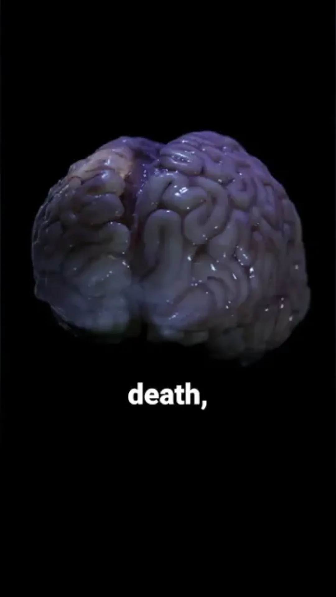 Vídeo realista mostra o que acontece com o cérebro dentro de 10 minutos após a morte