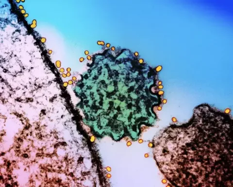 Tailândia faz triagem de 1.700 pessoas por causa do vírus mortal Nipah enquanto medidas ao estilo da Covid são adotadas nos aeroportos