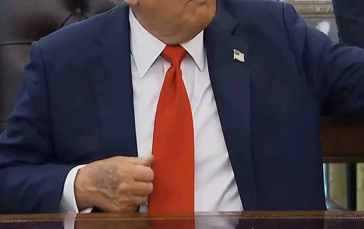 Trump aparece com mão roxa após diagnóstico de insuficiência