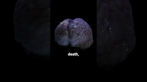 Vídeo realista mostra o que acontece com o cérebro dentro de